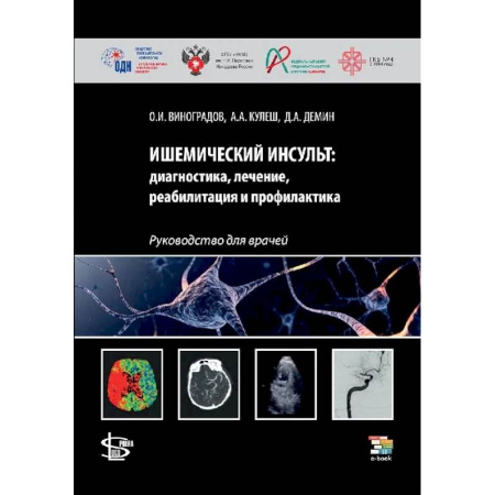 Кардиология, книга Ишемический инсульт: диагностика, лечение, реабилитация и профилактика. Руководство для врачей купить по низкой цене