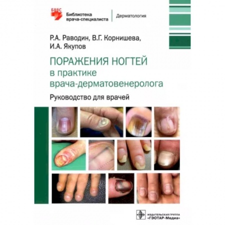 Кожные и венерические болезни, книга Поражения ногтей в практике врача-дерматовенеролога. Руководство для врачей купить по низкой цене