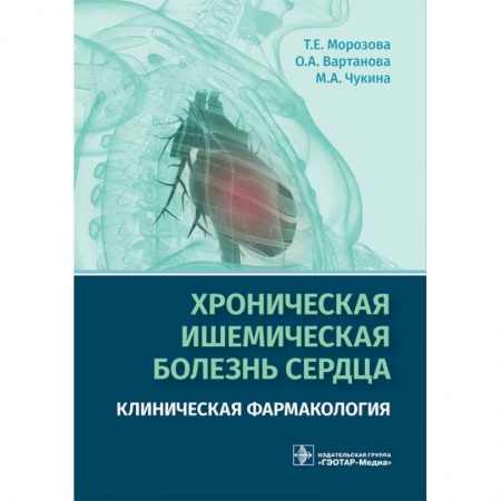 Кардиология, книга Хроническая ишемическая болезнь сердца. Клиническая фармакология купить по низкой цене