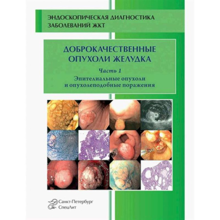 Онкология, книга Доброкачественные опухоли желудка. Часть1: Эпителиальные опухоли и опухолеподобные поражения: Учебно-методическое пособие купить по низкой цене