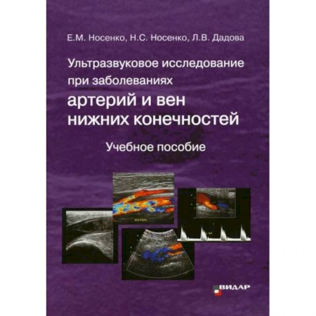 УЗИ. ЭКГ. Томография. Рентген, книга Ультразвуковое исследование при заболеваниях артерий и вен нижних конечностей купить по низкой цене