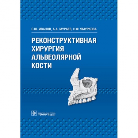 Книги, книга Реконструктивная хирургия альвеолярной кости купить по низкой цене