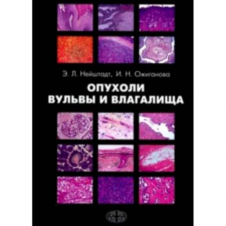 Акушерство и гинекология, книга Опухоли вульвы и влагалища купить по низкой цене