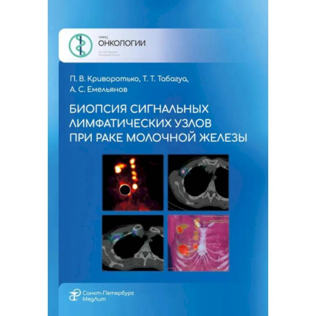 Онкология, книга Биопсия сигнальных лимфатических узлов при раке молочной железы купить по низкой цене