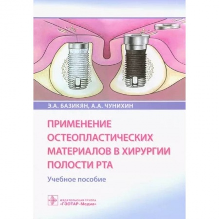 Стоматология, книга Применение остеопластических материалов в хирургии полости рта купить по низкой цене