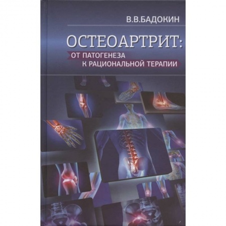 Внутренние болезни. Диагностика, книга Остеоартрит: от патогенеза к рациональной терапии купить по низкой цене