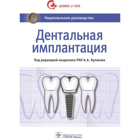 Стоматология, книга Дентальная имплантация. Национальное руководство купить по низкой цене
