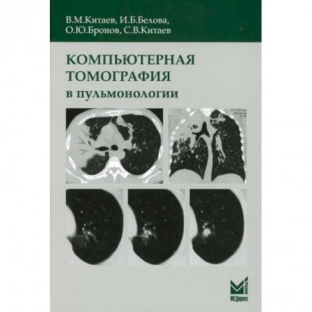 Другие виды специальной медицины, книга Компьютерная томография в пульмонологии купить по низкой цене