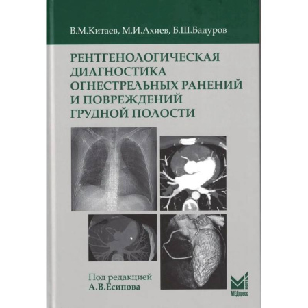 УЗИ. ЭКГ. Томография. Рентген, книга Рентгенологическая диагностика огнестрельных ранений и повреждений грудной полости купить по низкой цене