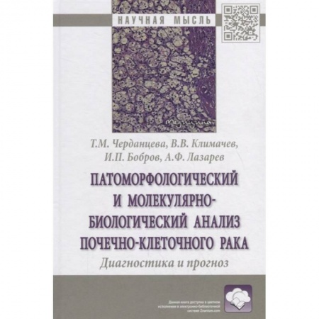 Онкология, книга Патоморфологический и молекулярно-биологический анализ почечно-клеточного рака. Диагностика и прогноз. Монография купить по низкой цене