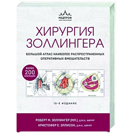 Хирургия. Ортопедия, книга Хирургия Золлингера. Большой атлас наиболее распространенных оперативных вмешательств купить по низкой цене