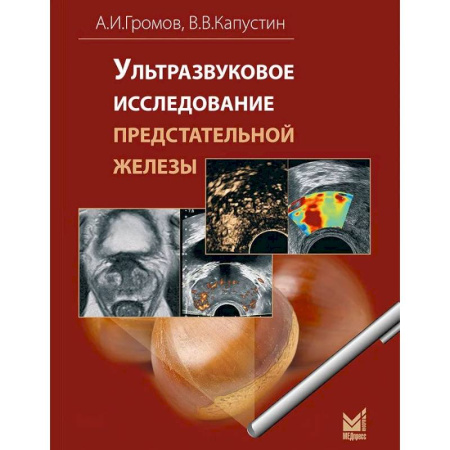 УЗИ. ЭКГ. Томография. Рентген, книга Ультразвуковое исследование предстательной железы купить по низкой цене