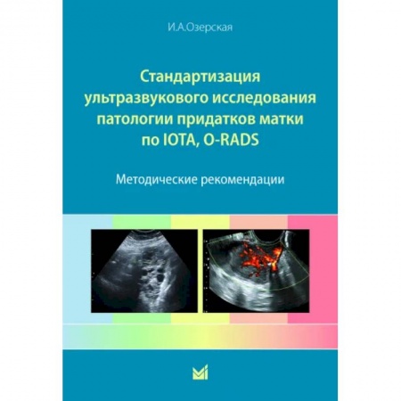 УЗИ. ЭКГ. Томография. Рентген, книга Стандартизация ультразвукового исследования патологии придатков матки по IOTA, O-RADS купить по низкой цене