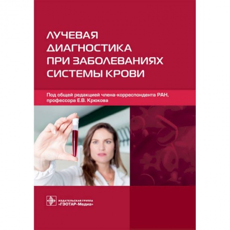УЗИ. ЭКГ. Томография. Рентген, книга Лучевая диагностика при заболеваниях системы крови купить по низкой цене