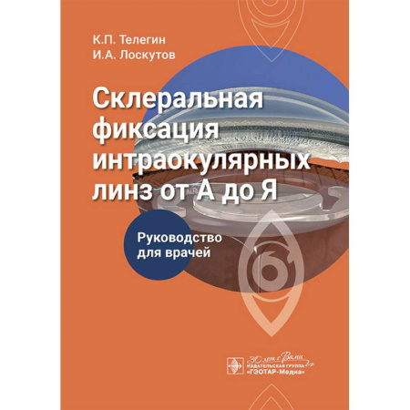 Офтальмология, книга Склеральная фиксация интраокулярных линз от А до Я купить по низкой цене