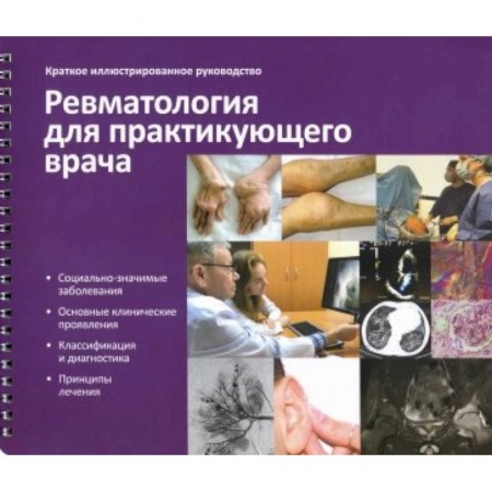 Внутренние болезни. Диагностика, книга Краткое иллюстрированное руководство «Ревматология для практикующего врача» купить по низкой цене
