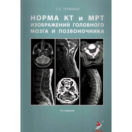 Другие виды специальной медицины, книга Норма КТ-и МРТ-изображений головного мозга и позвоночника купить по низкой цене