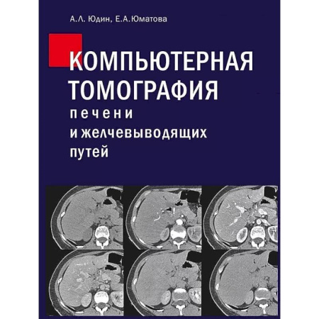 УЗИ. ЭКГ. Томография. Рентген, книга Компьютерная томография печени и желчевыводящих путей: практическое руководство купить по низкой цене