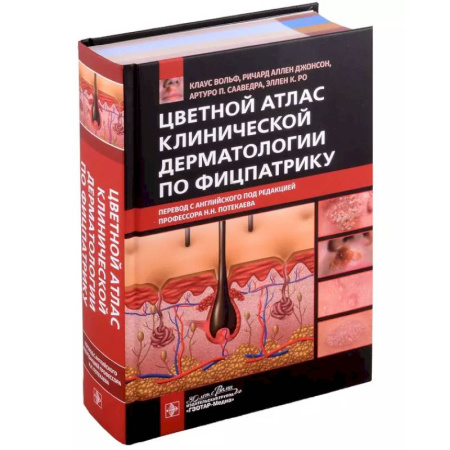 Кожные и венерические болезни, книга Цветной атлас клинической дерматологии по Фицпатрику купить по низкой цене