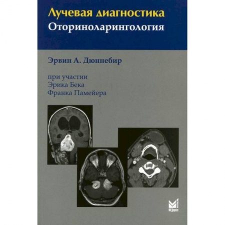 УЗИ. ЭКГ. Томография. Рентген, книга Лучевая диагностика. Оториноларингология купить по низкой цене