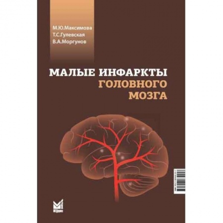 Неврология, книга Малые инфаркты головного мозга купить по низкой цене