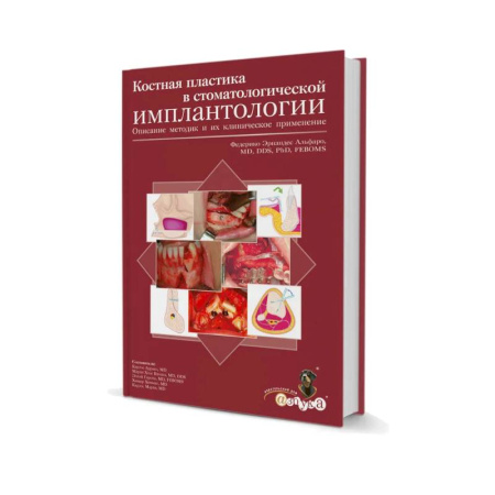 Стоматология, книга Костная пластика в стоматологической имплантологии. Описание методик и их клинического применения купить по низкой цене