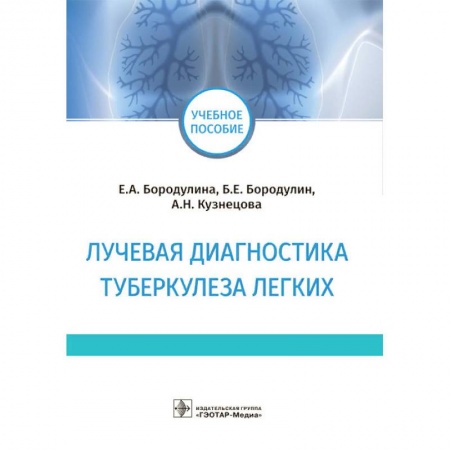 Терапия. Пульмонология, книга Лучевая диагностика туберкулеза легких купить по низкой цене