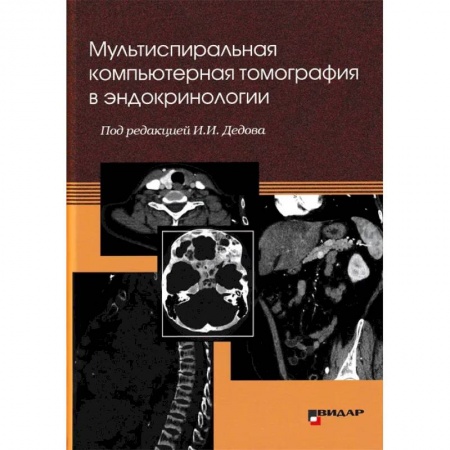 УЗИ. ЭКГ. Томография. Рентген, книга Мультиспиральная компьютерная томография в эндокринологии купить по низкой цене