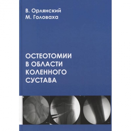 Хирургия. Ортопедия, книга Остеотомии в области коленного сустава купить по низкой цене