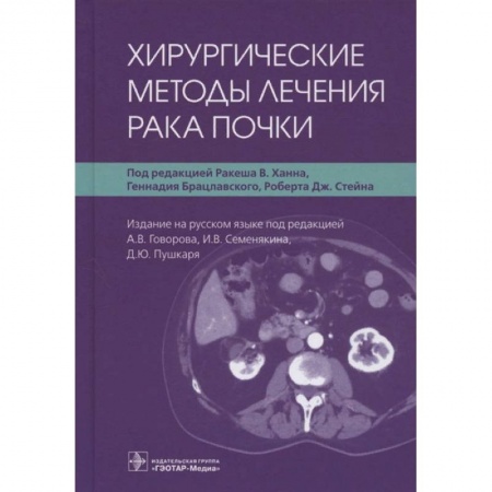 Урология, книга Хирургические методы лечения рака почки купить по низкой цене
