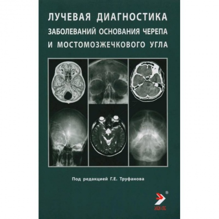 Неврология, книга Лучевая диагностика заболеваний оснований черепа и мостмозжечкового угла купить по низкой цене