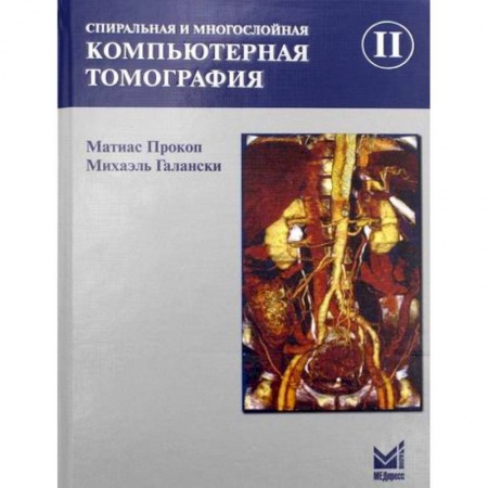 УЗИ. ЭКГ. Томография. Рентген, книга Спиральная и многослойная компьютерная томография купить по низкой цене