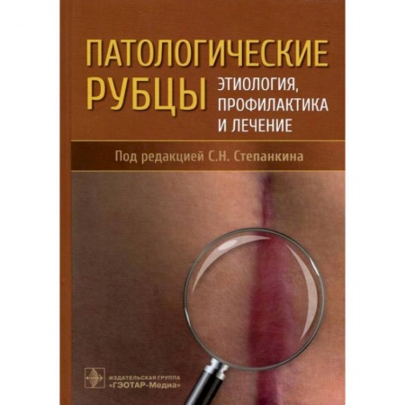 Хирургия. Ортопедия, книга Патологические рубцы. Этиология, профилактика и лечение купить по низкой цене