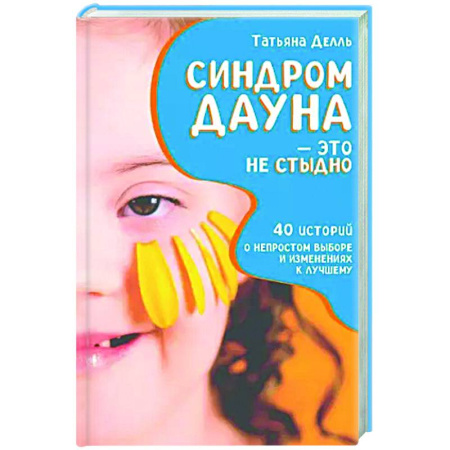 Детские болезни. Основные сведения, книга Синдром Дауна - это не стыдно: Как быть рядом с особенным ребенком и не потерять себя. 40 историй о непростом выборе и изменениях к лучшему купить по низкой цене