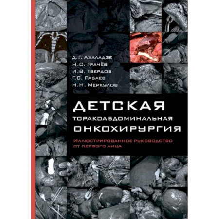 Онкология, книга Детская торакоабдоминальная онкохирургия. Иллюстрированное руководство от первого лица купить по низкой цене