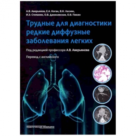Терапия. Пульмонология, книга Трудные для диагностики редкие диффузные заболеваниях легких: монография купить по низкой цене