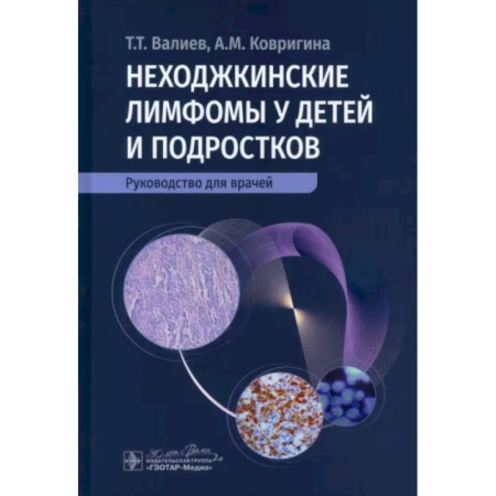 Педиатрия, книга Неходжкинские лимфомы у детей и подростков купить по низкой цене