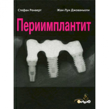 Стоматология, книга Периимплантит купить по низкой цене