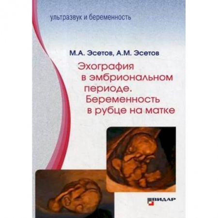 Акушерство и гинекология, книга Эхография в эмбриональном периоде. Беременность в рубце на матке купить по низкой цене