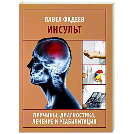 Кардиология, книга Инсульт. Причины, диагностика, лечение и реабилитация купить по низкой цене