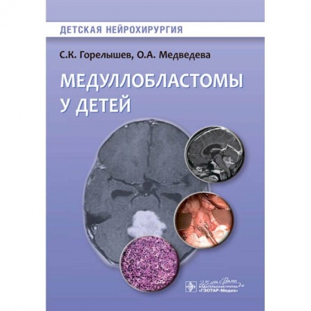 Хирургия. Ортопедия, книга Медуллобластомы у детей купить по низкой цене
