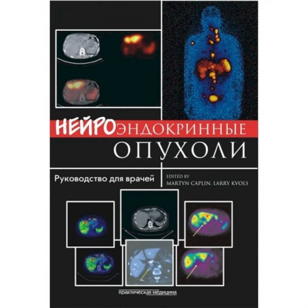 Онкология, книга Нейроэндокринные опухоли. Руководство для врачей купить по низкой цене