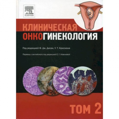 Онкология, книга Клиническая онкогинекология. В 3 томах. Том 2 купить по низкой цене