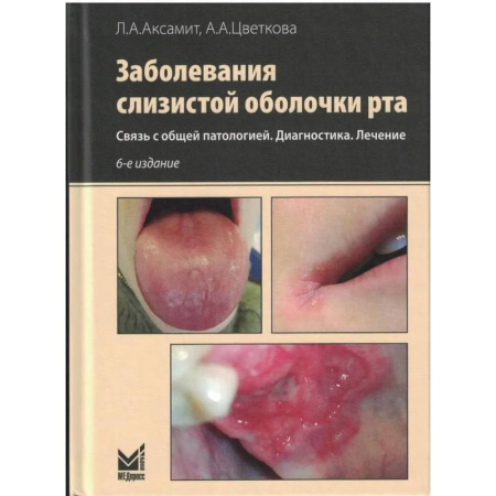 Медицинские энциклопедии и справочники, книга Заболевания слизистой оболочки рта. Связь с общей патологией. Диагностика. Лечение купить по низкой цене