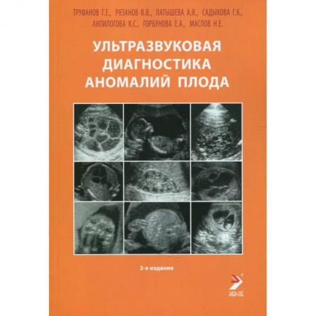 Акушерство и гинекология, книга Ультразвуковая диагностика аномалий плода: Руководство для врачей купить по низкой цене
