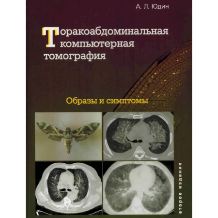 Специальная медицина, книга Торакоабдоминальная компьютерная томография. Образы и симптомы купить по низкой цене