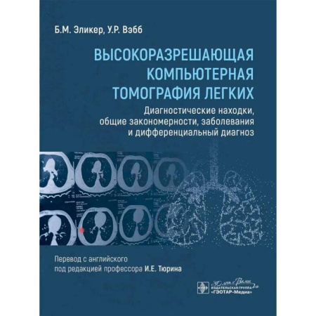 Медицинские энциклопедии и справочники, книга Высокоразрешающая компьютерная томография легких. Диагностические находки, общие закономерности, заболевания и дифференциальный диагноз купить по низкой цене
