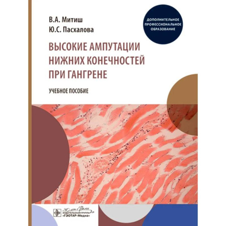 Медицинские энциклопедии и справочники, книга Высокие ампутации нижних конечностей при гангрене купить по низкой цене