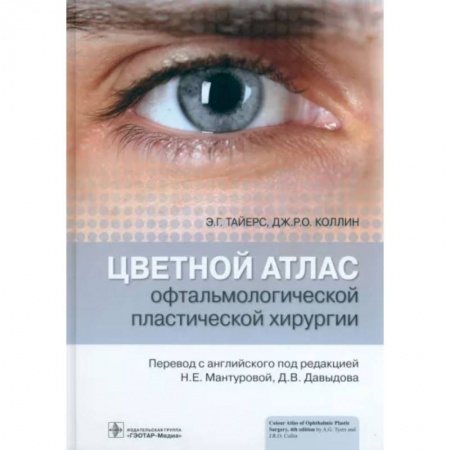 Офтальмология, книга Цветной атлас офтальмологической пластической хирургии купить по низкой цене