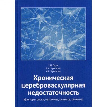Кардиология, книга Хроническая цереброваскулярная недостаточность купить по низкой цене